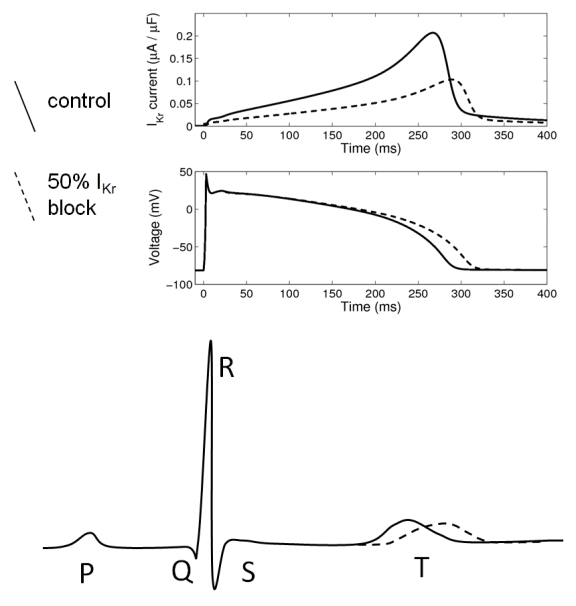 Figure 1: Relationship between ion current block, action potential duration, and QT interval. Top: IKr current, Middle: action potential (both simulated); Bottom: my artistic impression of the corresponding changes to the whole body ECG.
